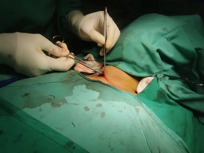 A clinician performs thyroid surgery on a patient.